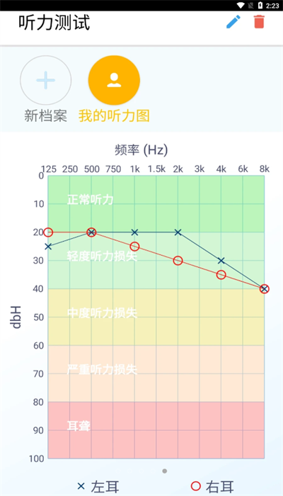 艾米助听