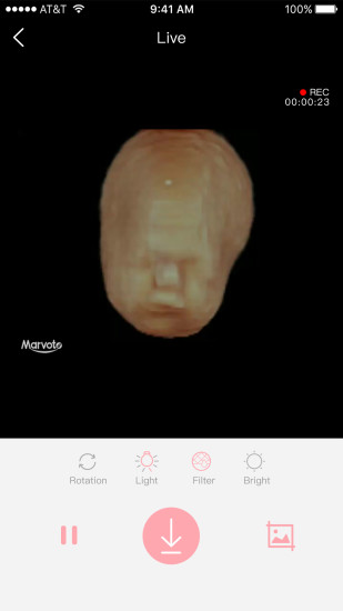 体内相机app安卓版