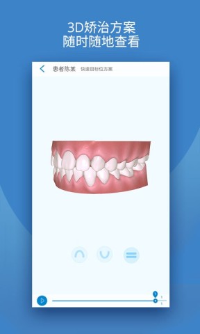 iOrtho时代天使
