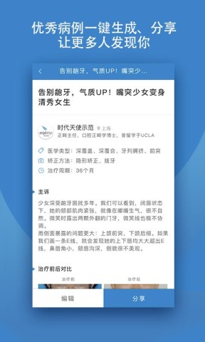 iOrtho时代天使 第2张图