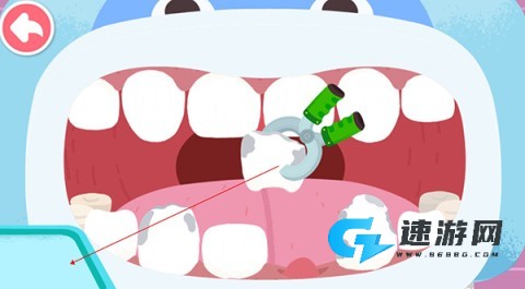 宝宝牙齿美容 第5张图