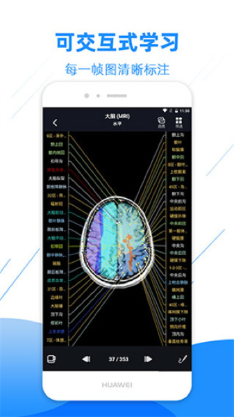 影像解剖图谱app